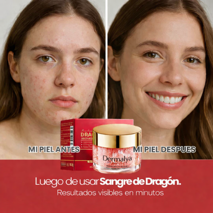 Piel de porcelana en minutos - Crema hidratante antienvejecimiento - Dermalya™